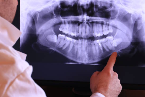 Best Dentist for Tooth Abscess  in Morgan, UT